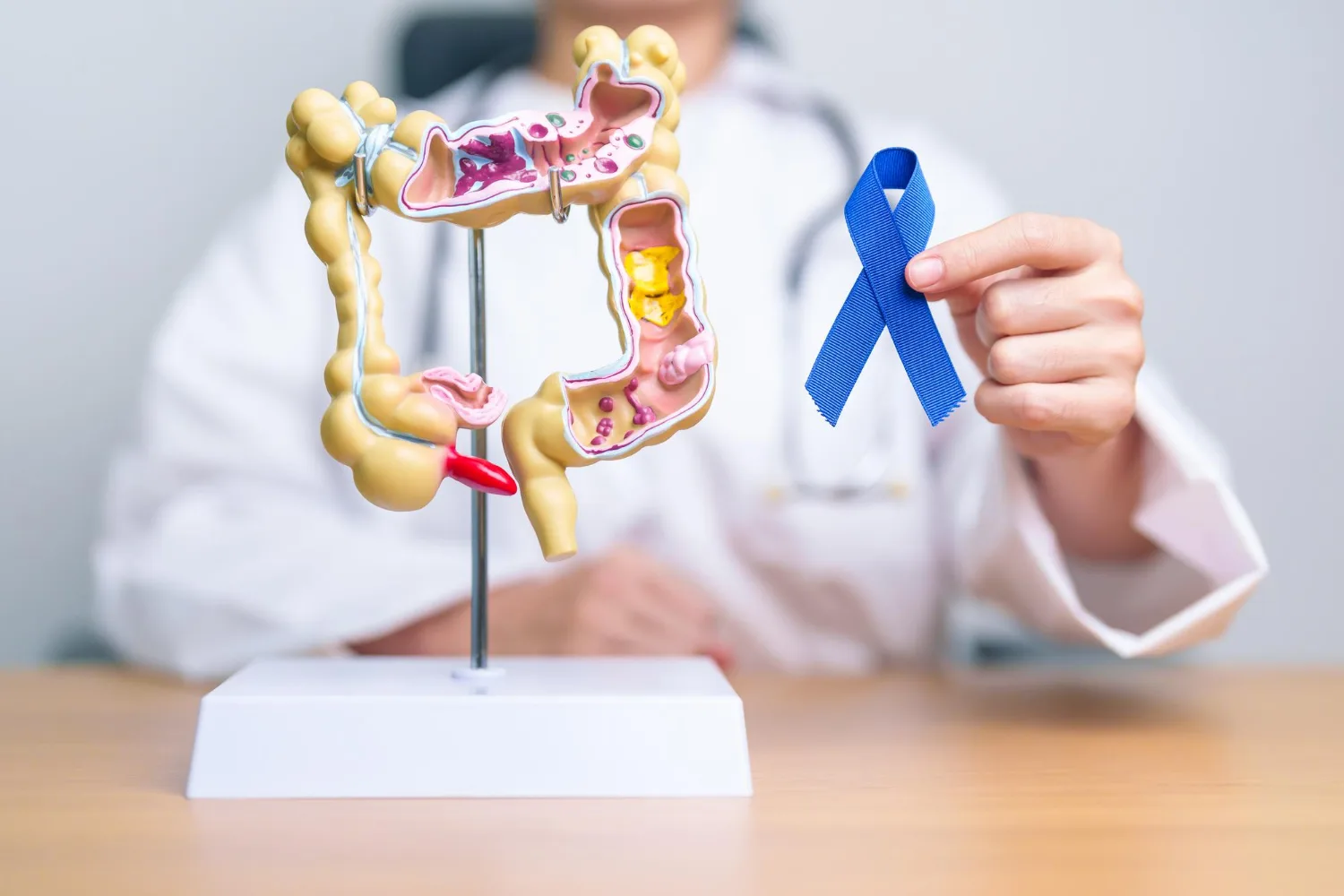 Detección temprana de Cáncer Colorrectal en Querétaro y San Juan del Río